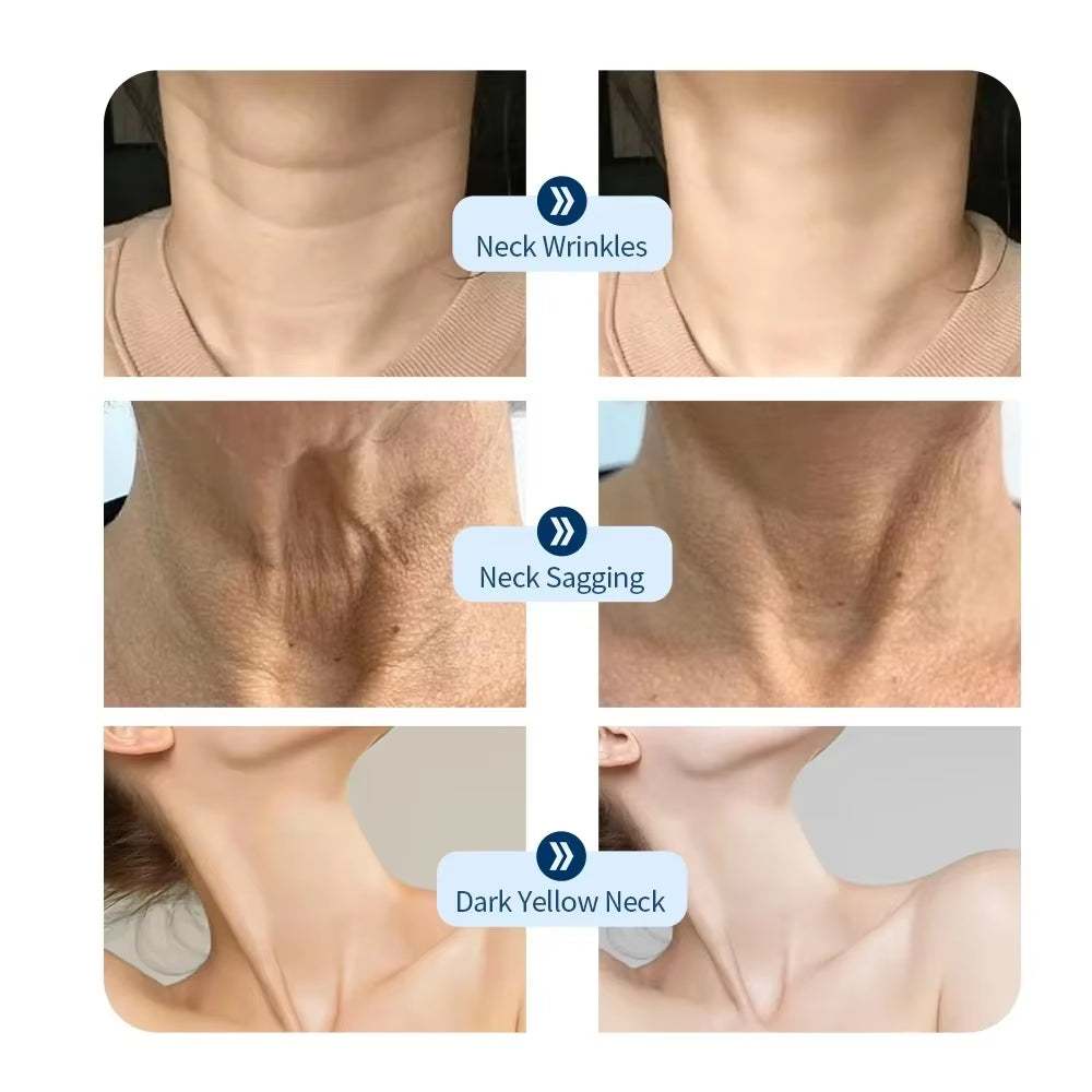 Seven Color Photon LED Mask showing before-and-after neck wrinkle, sagging, and dark yellow neck concerns