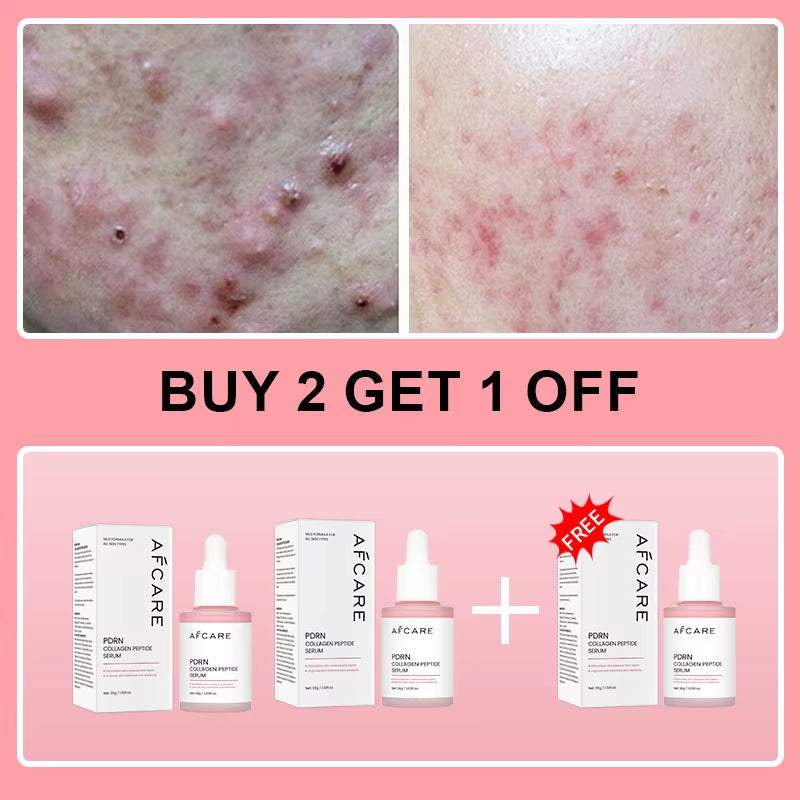 Korean Facial Serum, pink PDRN collagen peptide serum in a dropper bottle with matching box and free offer text