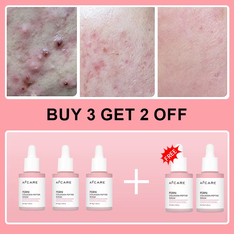 Collagen Peptide Facial Serum Targets Dull Skin Boosts Skin Elasticity Stimulates Skin Renewal Repair Salmon PDRN KOREAN Product