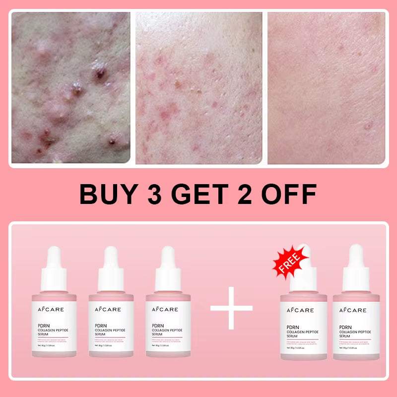 Korean Facial Serum in white dropper bottles, featuring pink PDRN collagen peptide labels and bundle display