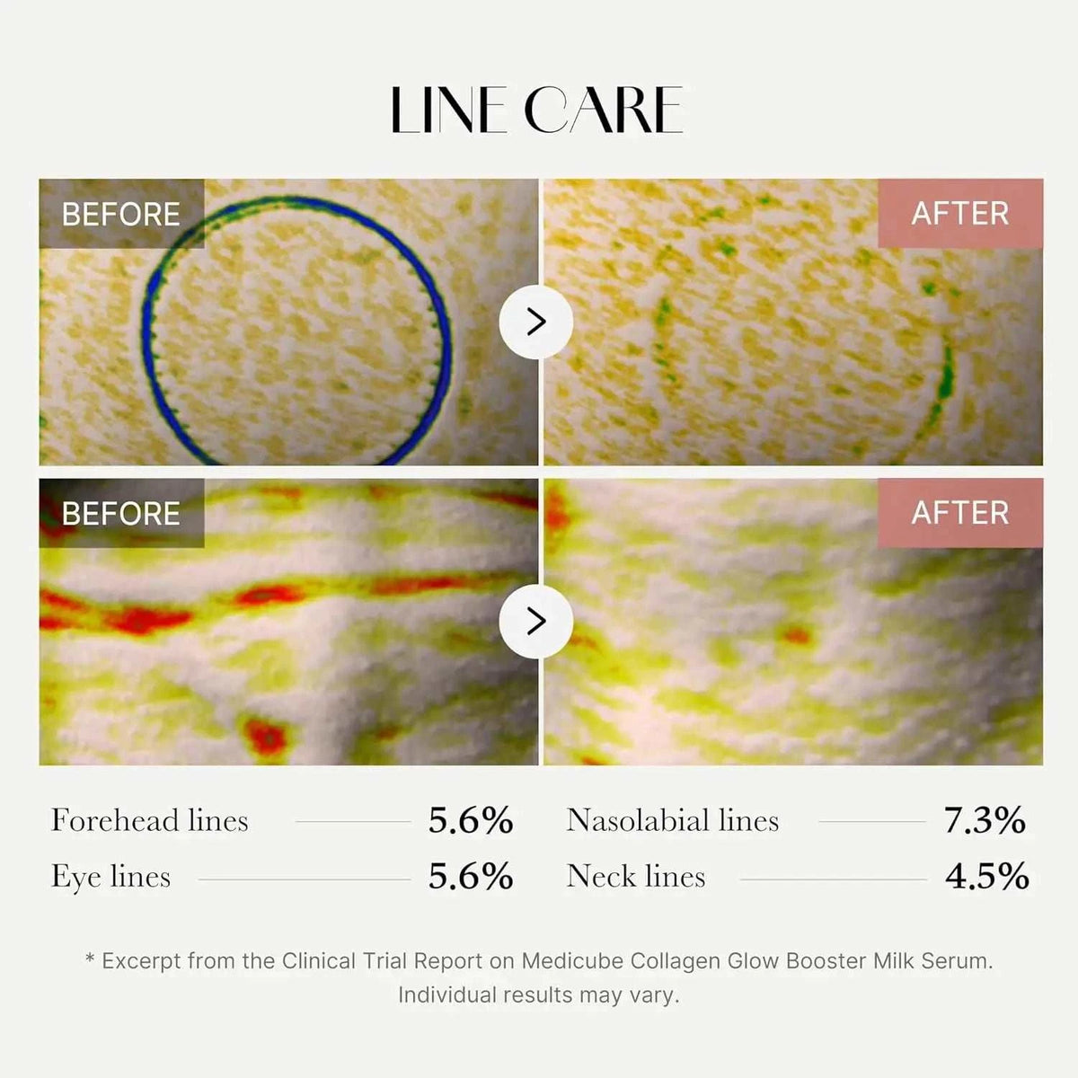 Collagen Glow Booster Milk Serum clinical trial graphic showing before-and-after skin texture and reduced lines percentages
