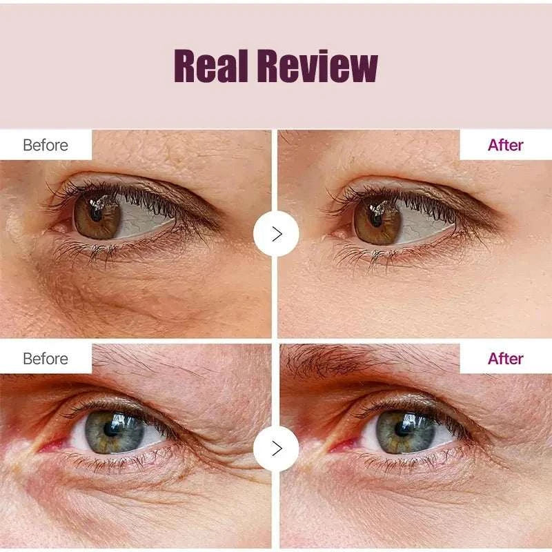 Wrinkle Bounce Moisturizing eye balm shown in before-and-after images, with a portable stick format for under-eye care