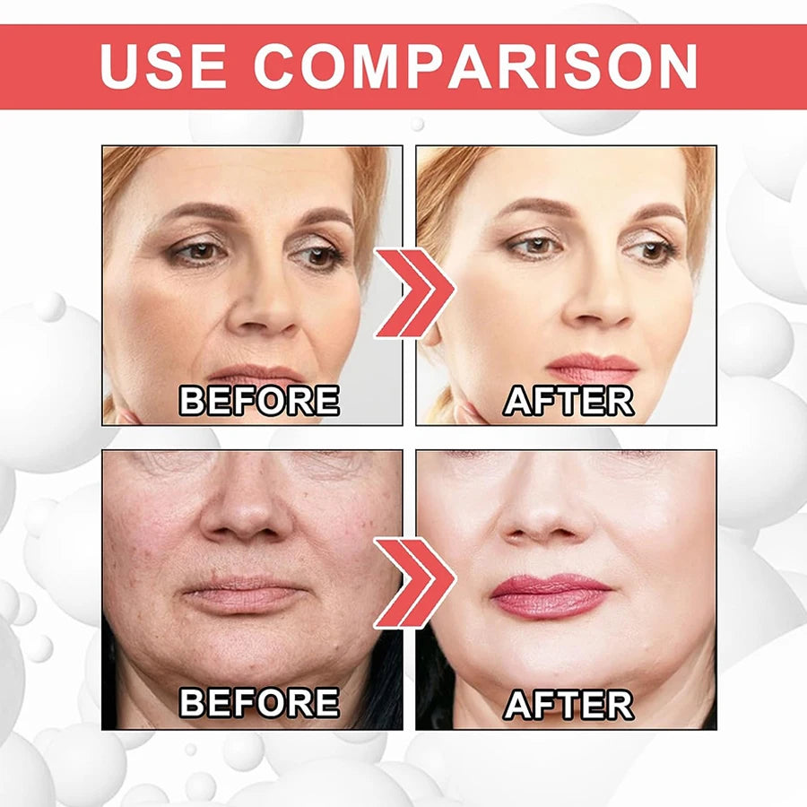 Collagen Peptide Matrixyl Serum
