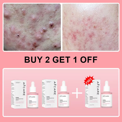 Collagen Peptide Facial Serum Targets Dull Skin Boosts Skin Elasticity Stimulates Skin Renewal Repair Salmon PDRN KOREAN Product