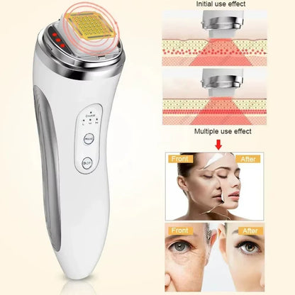 RF High Frequency Facial Care Radio Frequency Facial Beauty Lifting Machine Device Dot Matrix Wrinkle Removal Skin Tightening