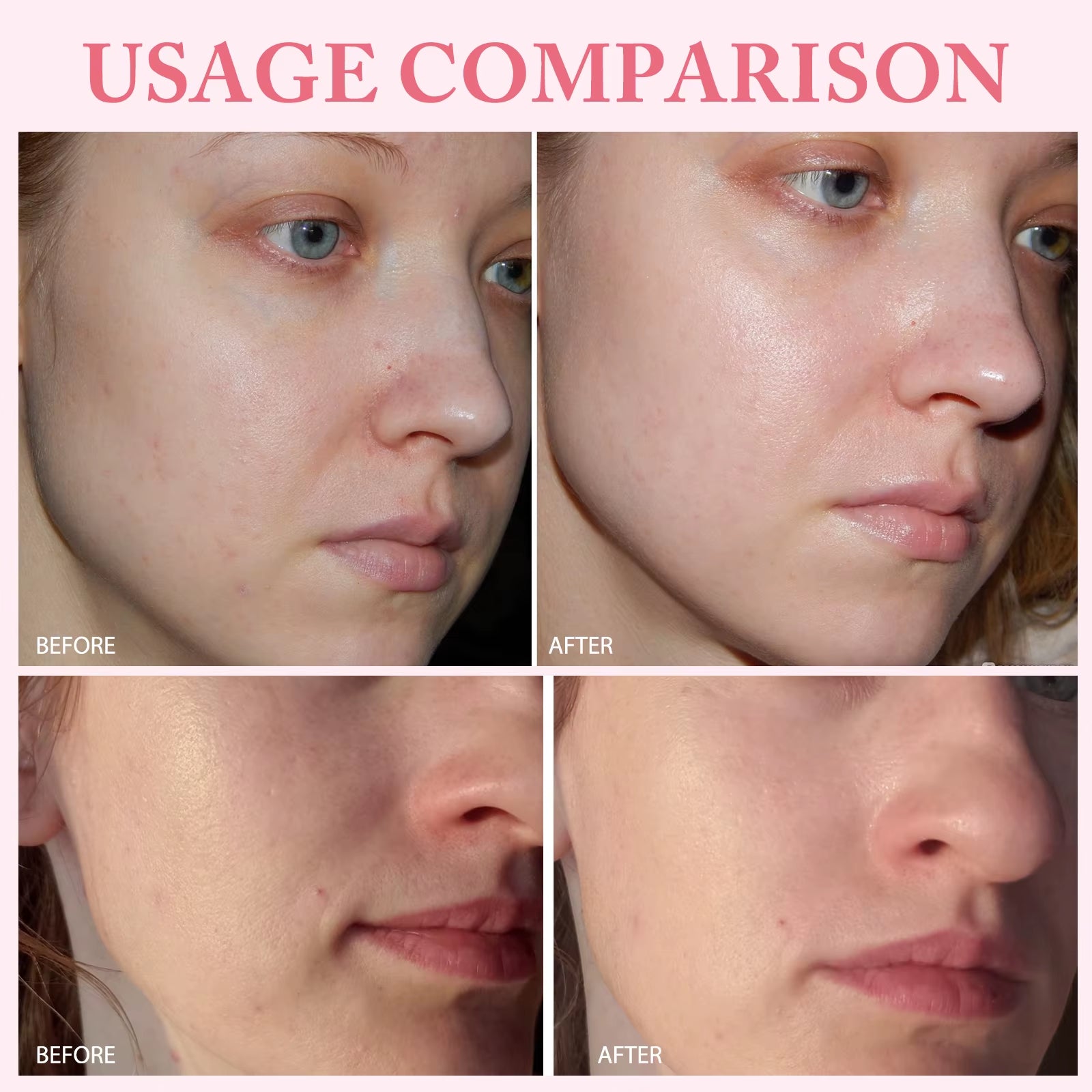 Revitalize Your Skin with 10Pcs PDRN Serum - Moisturizing, Brightening, and Anti-Aging Facial Treatment