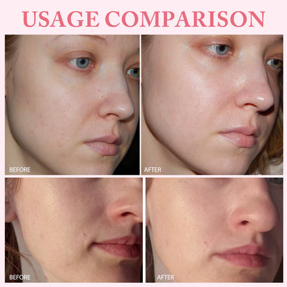 Revitalize Your Skin with 10Pcs PDRN Serum - Moisturizing, Brightening, and Anti-Aging Facial Treatment