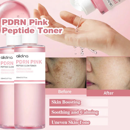 Face Moisturize for Uneven Skin Tone Face Moisturizer with Niacinamide