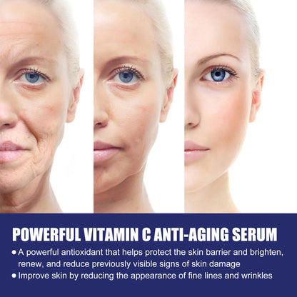 Vitamin C Anti-Aging Serum, Hydrating &amp; Firming Facial Treatment, Smooths Fine Lines for Youthful Skin