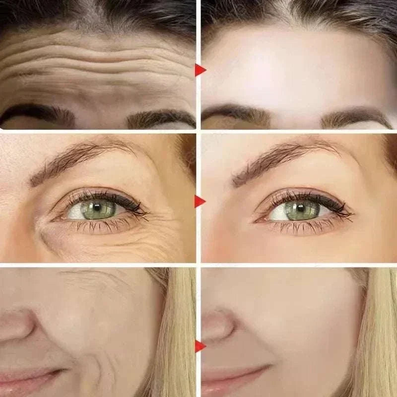 Brightening Anti Aging Serum shown with before-and-after facial comparisons highlighting smoother-looking forehead, eye, and cheek areas